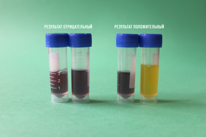 Экспресс-тест на определение молочнокислых бактерий (петритест)